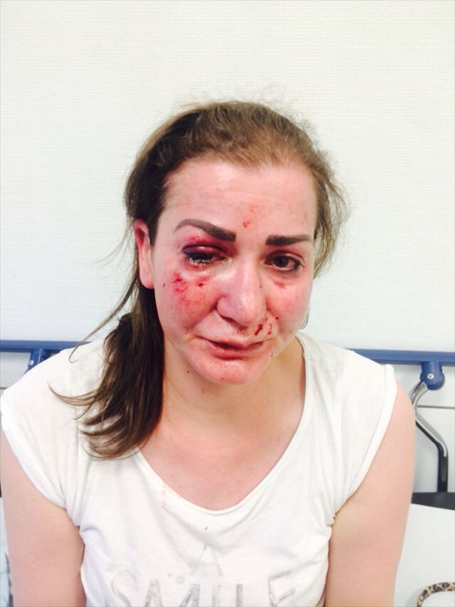 Almanya'da Türk kadına tramvayda saldırı 2