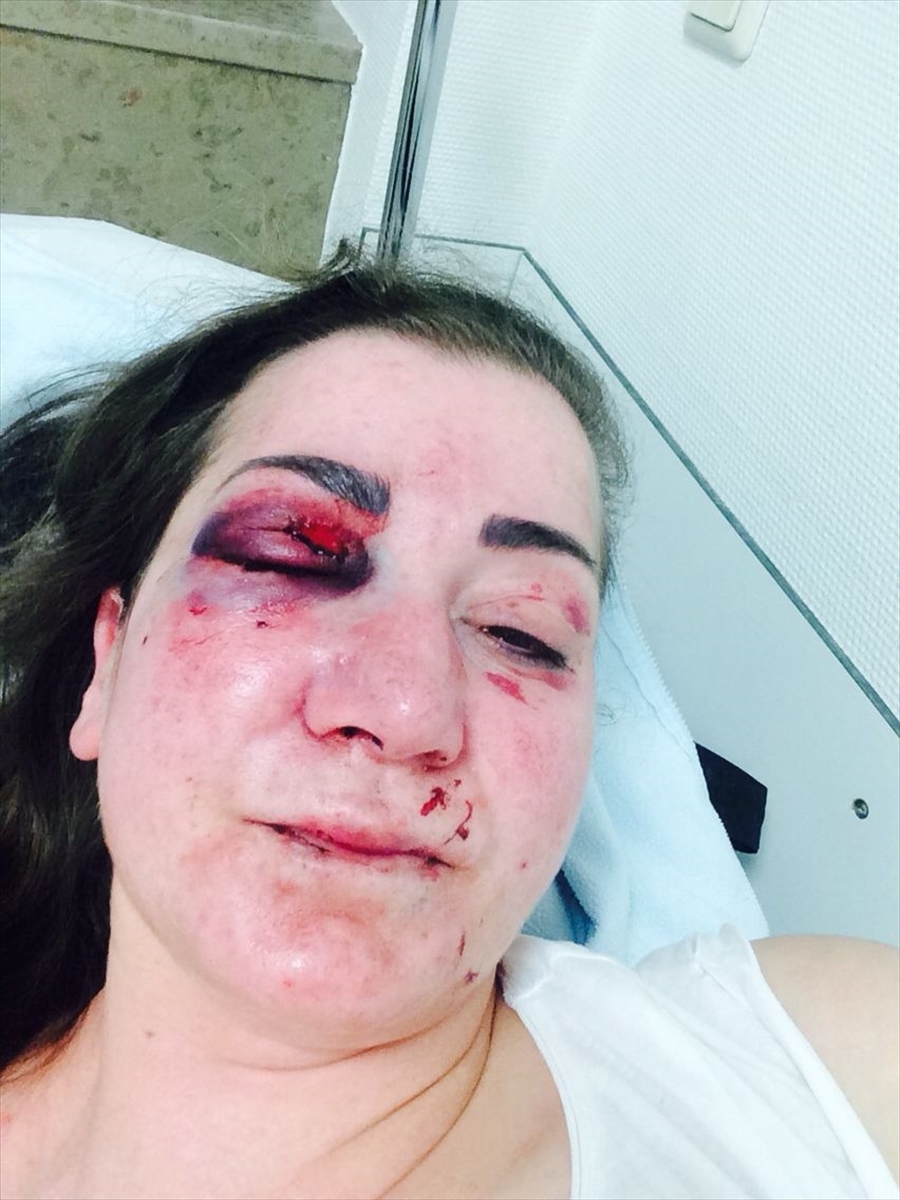 Almanya'da Türk kadına tramvayda saldırı 3
