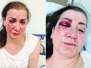 Almanya'nın Köln kentinde Türk kadına tramvayda saldırı