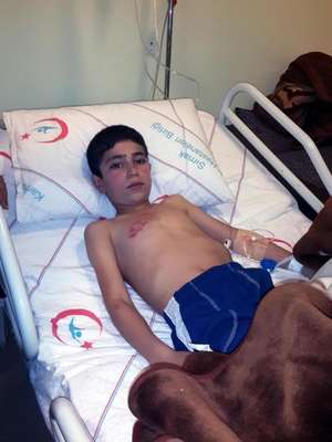 Cizre'de askeri araç taşlanınca olay çıktı: 1 yaralı