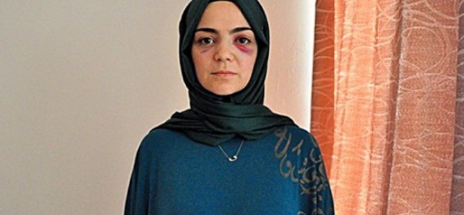 Almanya’da Türk kadını yumruklayan saldırgan Rus çıktı