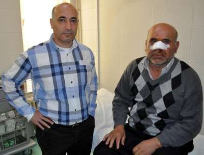 Burnu kesilince 5 hastane gezen hastaya 2 gün gecikmeli dikiş atıldı