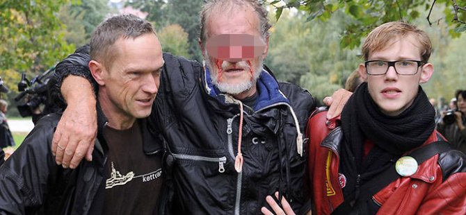 Almanya’da TOMA'dan yaralanan göstericiye 120 bin avro tazminat