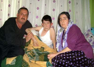 16 yaşındaki Orhan, 'Progeria' hastası