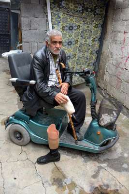Bacağı kesilen çiftçiye komşudan emanet motosiklet
