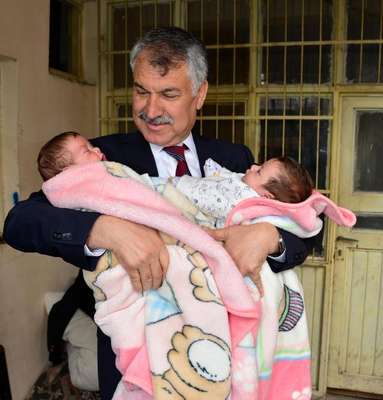 İkizlere yardım eli uzandı