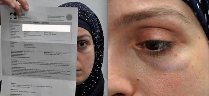 Almanya'da Türk kadına saldırı
