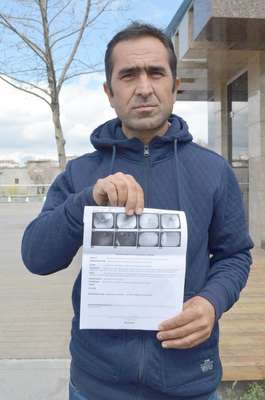 'İnatçı hıçkırıktan' kurtulmak istiyor