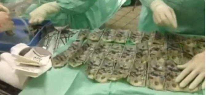 Paraları yutarak kocasından saklamış