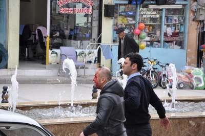 Besni'de komşu esnaf arasında 'ateş külü' kavgası: 1 yaralı