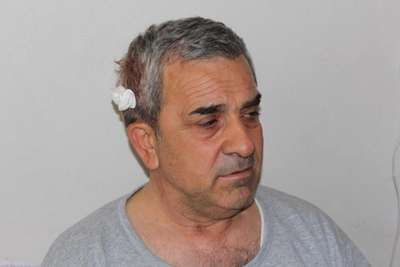 CHP Kırıkhan İlçe Başkanı'na sopalı saldırı