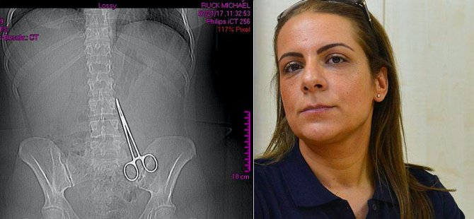 Türkiye'de karnında unutulan makasla 6 ay yaşadı