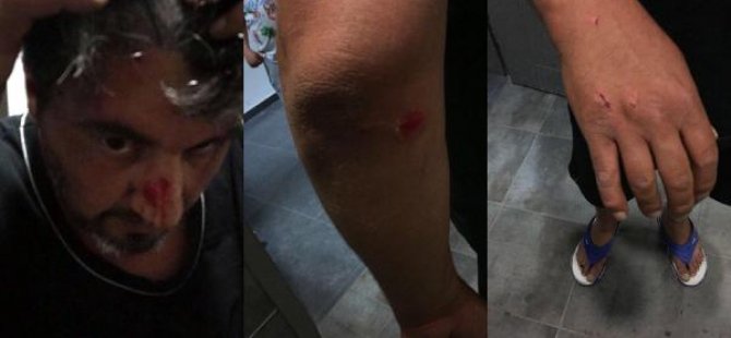 Bulgar gümrüğünde gurbetçi aileye 'dayak'