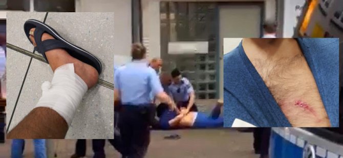 Alman polis köpeği bir Türk'e saldırdı