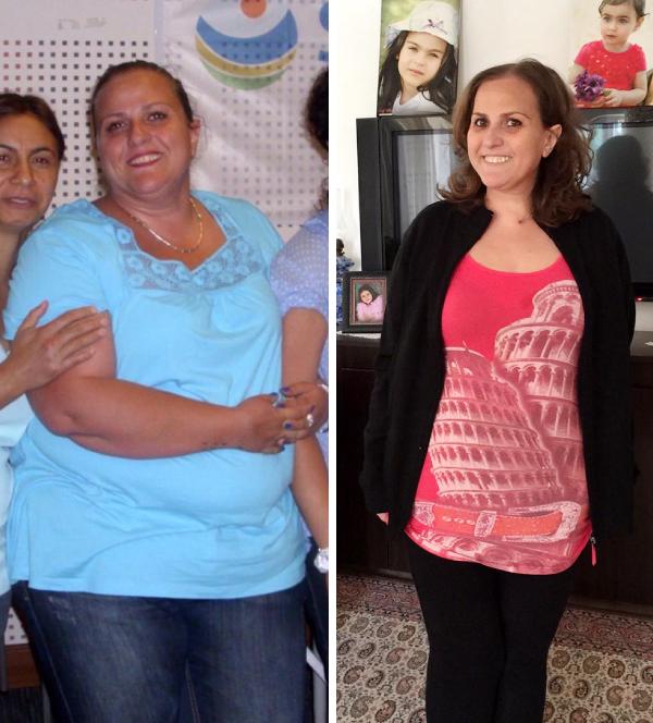 Ameliyatla 3 hastalıktan kurtuldu, 5 ayda 32 kilo verdi