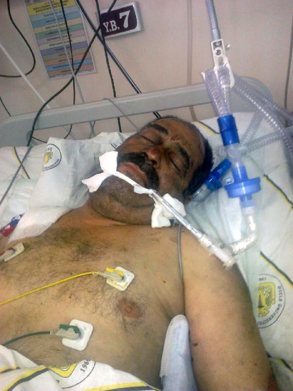 Diyarbakır'daki bombalı saldırıda ölenlerin sayısı 4'e yükseldi