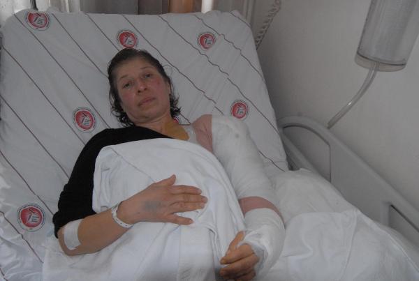 İki göstericinin kolunu kıran TOMA'daki polislere, soruşturma izni çıkmadı