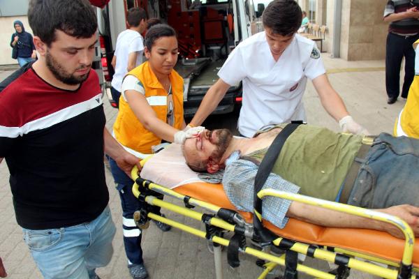 Lastikten fırlayan parça yüzünü yaraladı