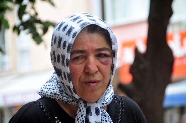 Oğlunun caddede dövdüğü anne bu hale geldi