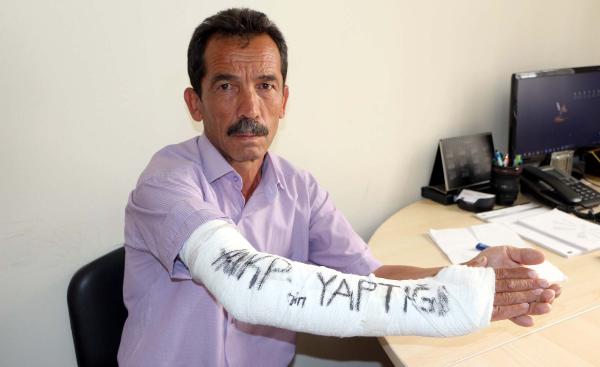 Kırılan kolundaki alçıya 'AKP'nin yaptığı' diye yazdı
