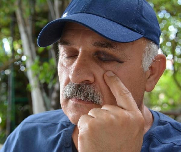Diş hekimine, hastasına yumruklu saldırı suçlaması