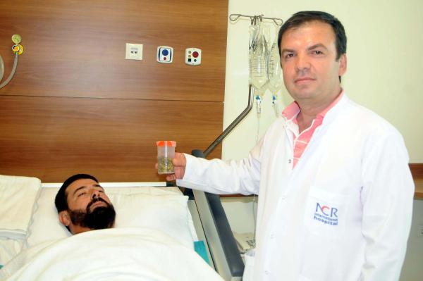 Safra kesesinden 512 taş çıktı