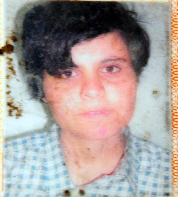 Zihinsel engelli Fatma'da haber alınamıyor
