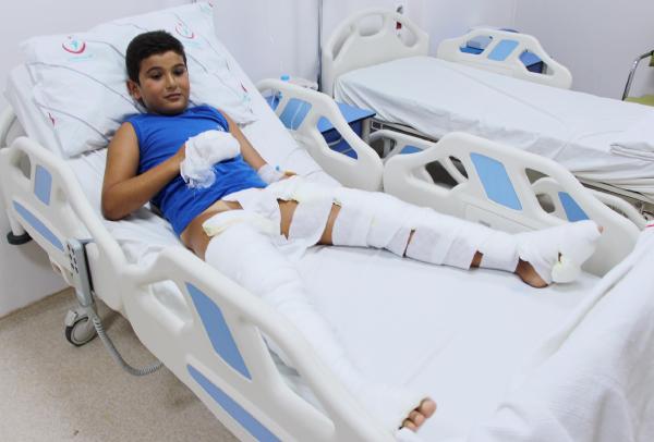 8 yaşındaki çocuğun üzerine otelde kaynar su döküldü