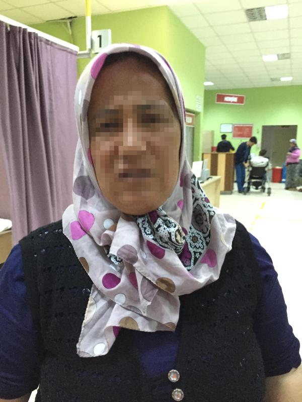 Eşinin hastanelik ettiği kadın: 12 yılda 3 kez kolumu kırdı