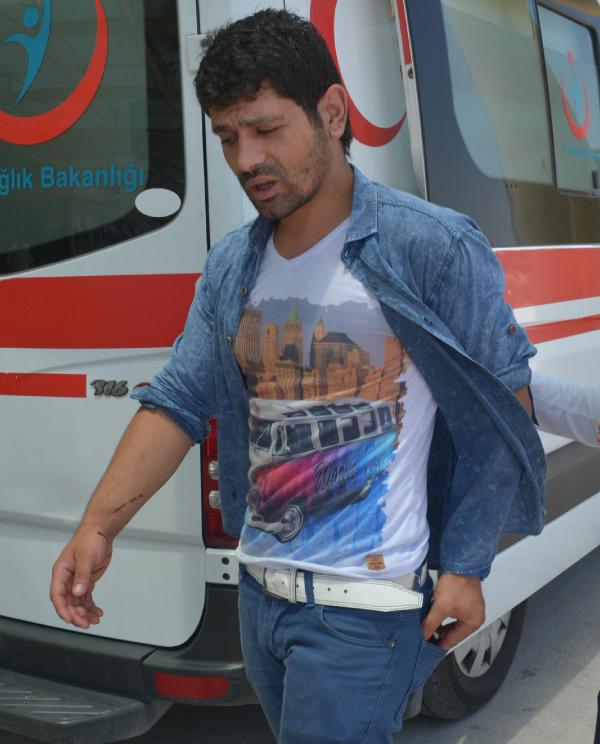Ayrı yaşadığı eşi tarafından bıçakla yaralandı