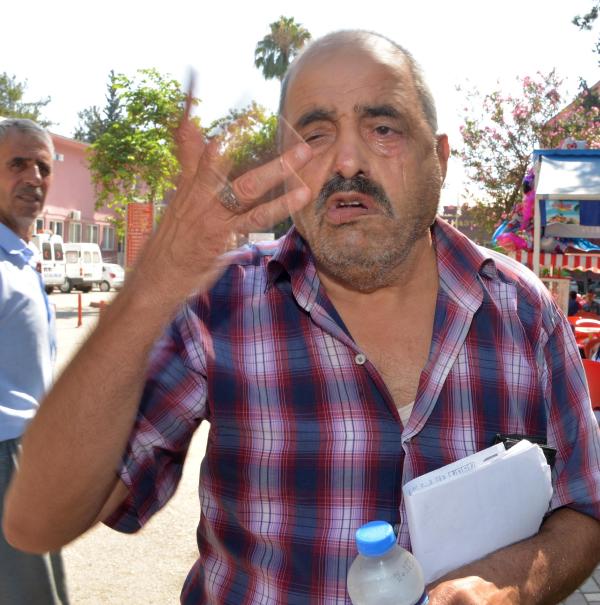 Gözünü morartan oğlundan şikayetçi oldu