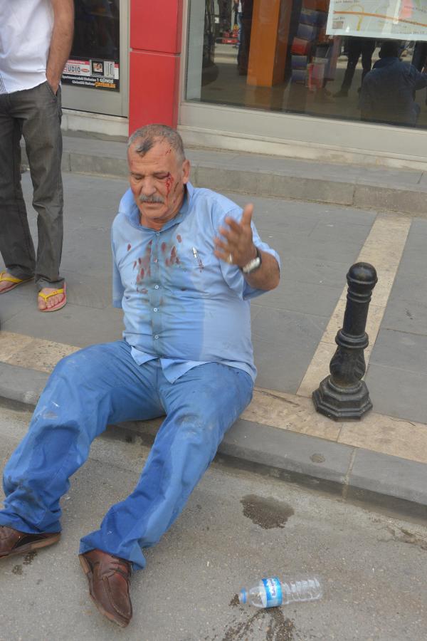 ESP'li Pişkinbaş, Suruç'taki patlamadan da yaralı kurtuldu