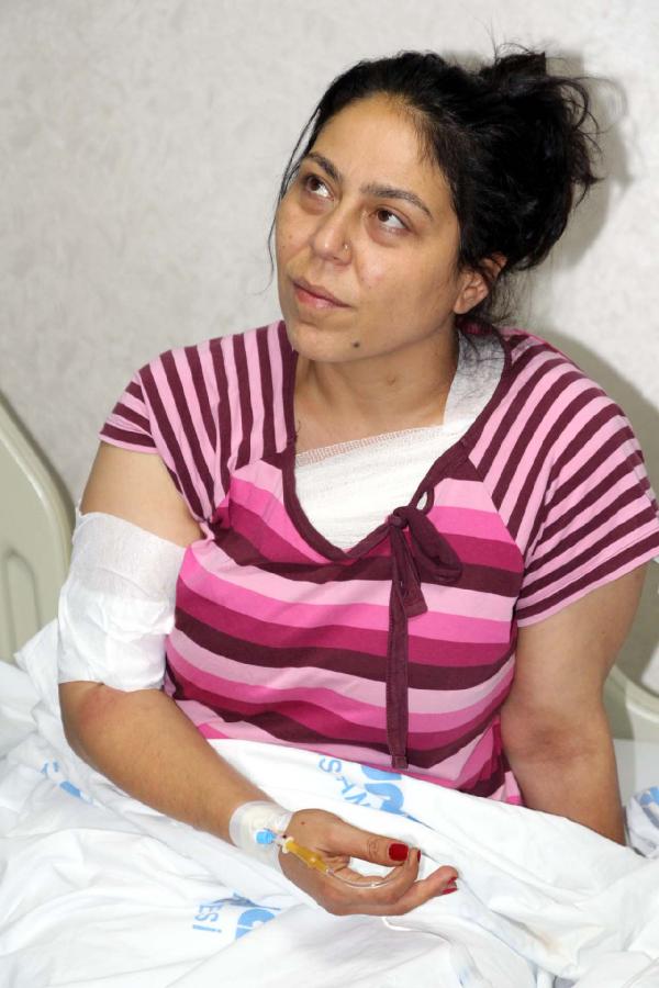 Suruç'ta yaralanan HDP'li, patlama anını anlattı