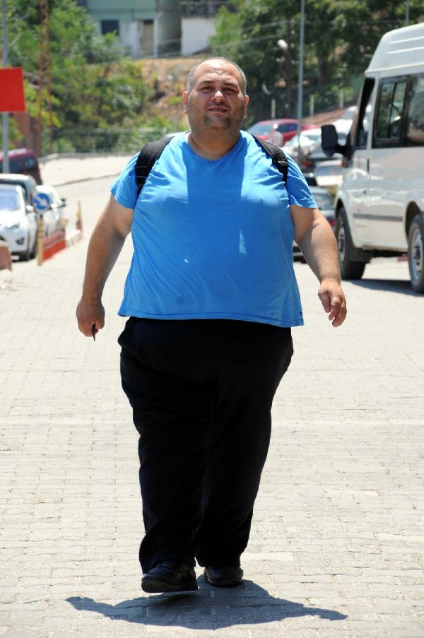 Mide küçültme ameliyatı oldu, 1 ayda 45 kilo zayıfladı