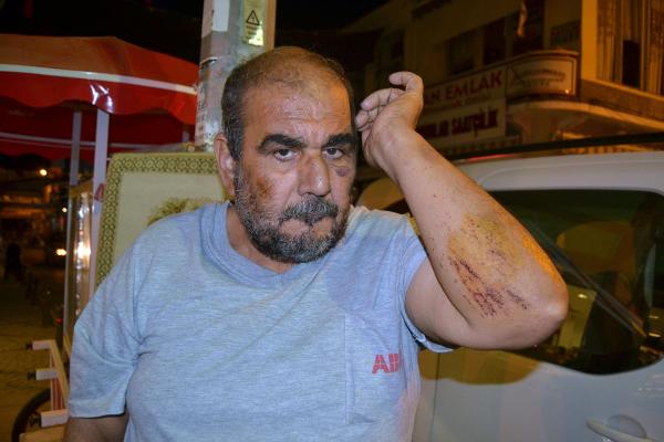 Sabah yürüyüşünde darp edip, hastanelik ettiler