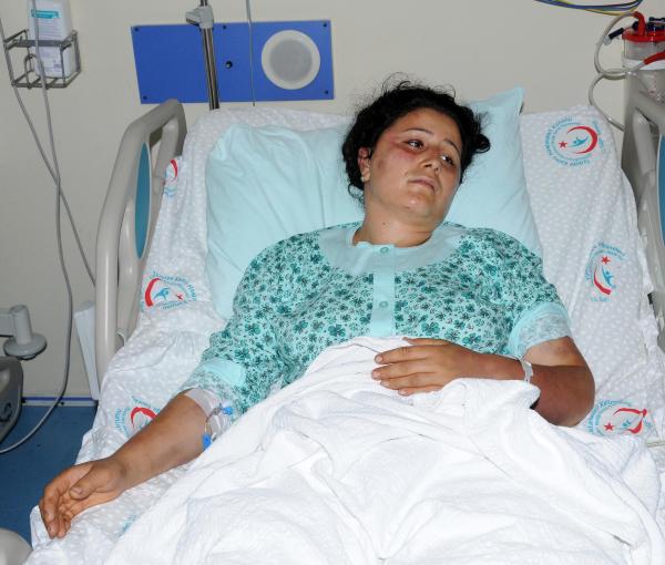 Eşini keser ve çekiçle döverek hastanelik etti