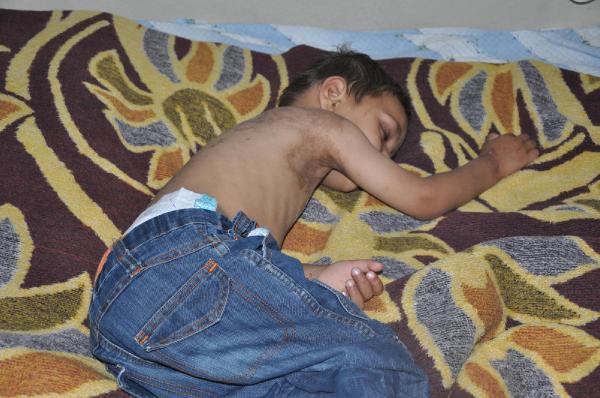 IŞİD'in bombasıyla yaralanan Suriyeli aile İnegöl’e geldi
