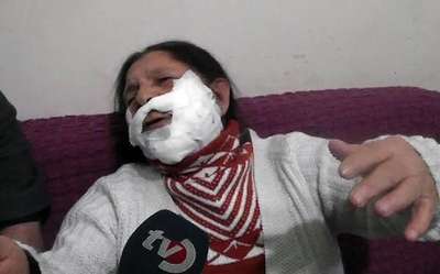 Mutfak dolabı düştü, yemek yapan kadın yaralandı