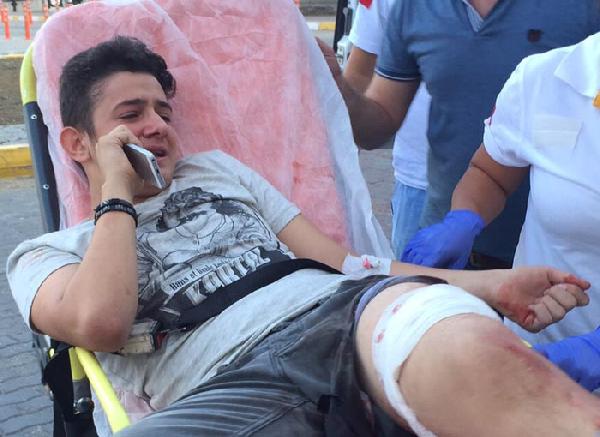 Gitar kavgası kanlı bitti: 1 yaralı