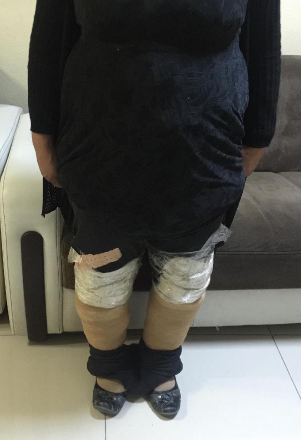 Bacağına 2 kilo eroin saran kadın tutuklandı