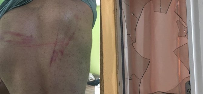Gurbetçi kızı isteme kavgası: 10 yaralı