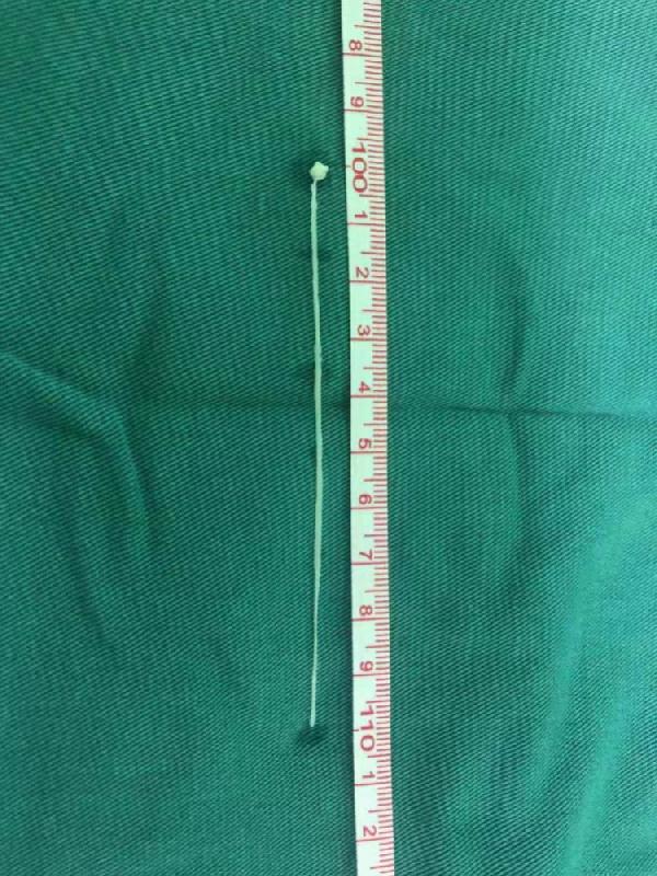 Beyninde kurtla 30 yıl yaşadı