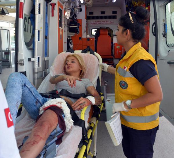 Kıskanç sevgili Merve'nin yüzünü kesti