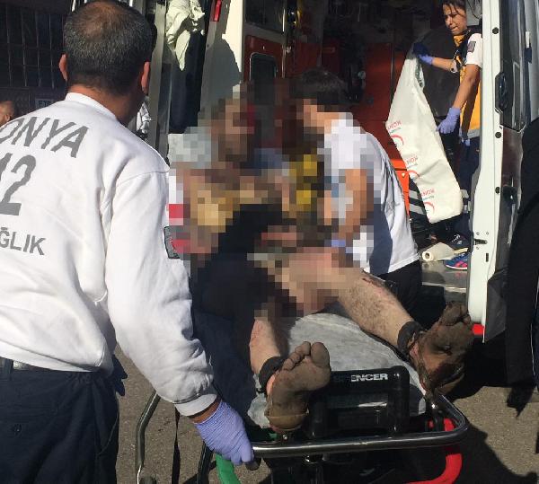 Döküm kazanı patladı: 2 kişi yaralandı
