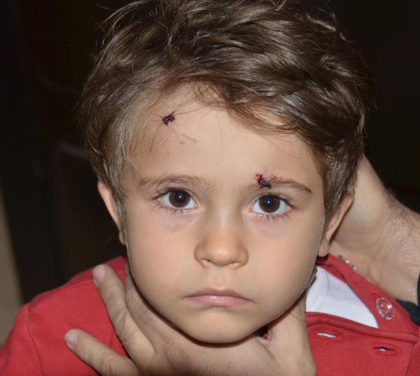 Köpeğin saldırdığı 3 yaşındaki Elif, hastanelik oldu