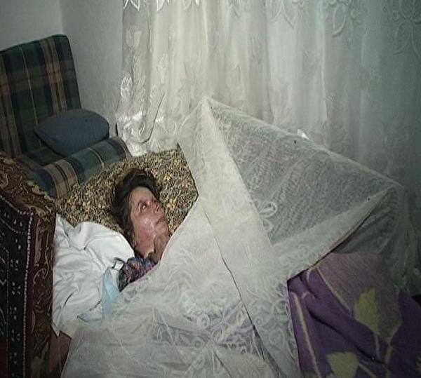 Boşanmak istedi, eşinin kezzaplı saldırısı ile yaşamı karardı