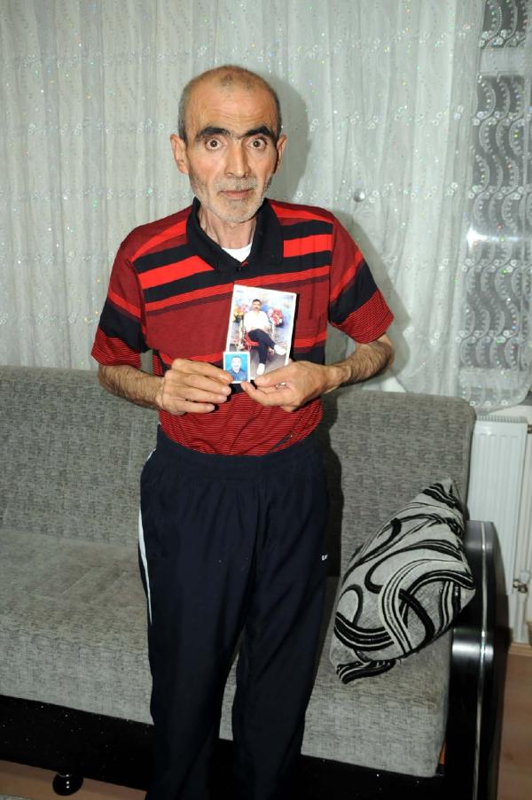Rahatsızlanınca 1.5 yılda 45 kilo zayıflayan kişi öldü