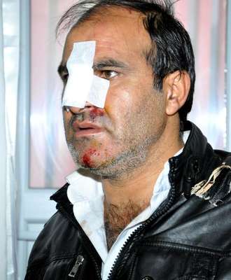 İşçi taşıyan otobüsle TIR çarpıştı: 4 ölü, 47 yaralı (4)