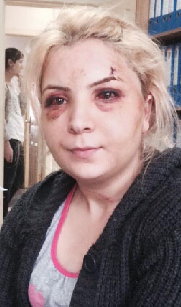 'Eski kocam dövdü' diye karakola gitti, cinayet davasında ceza aldığı ortaya çıktı