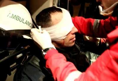 Protestolarda yaralanan Kosova Polisi Özel Harekat Birimi Başkanı’nın tedavisi Türkiye’de devam edecek